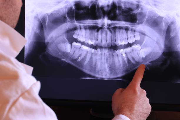 Best Emergency Tooth Extraction in Rockfish, NC