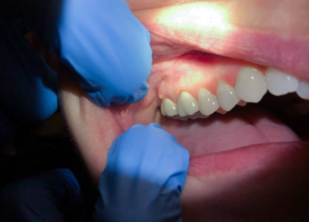 Best Same-Day Emergency Dental Services in Rockfish, NC